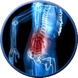 back pain x-ray